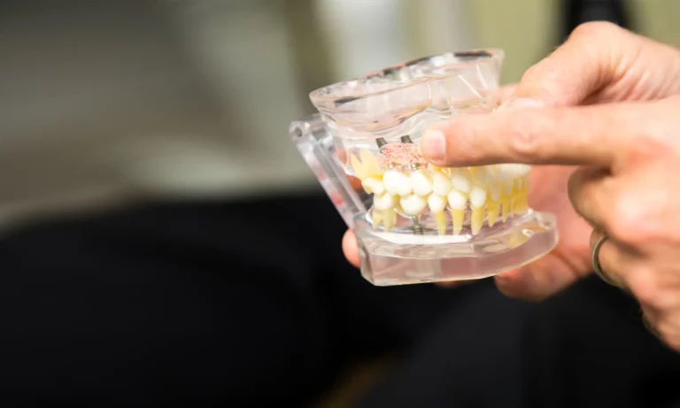dr bingham holding dental implant model