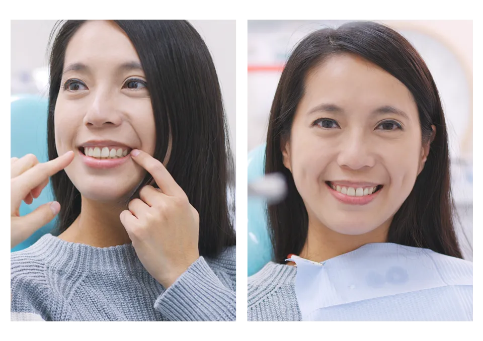 patient smiling after functional crown lengthening