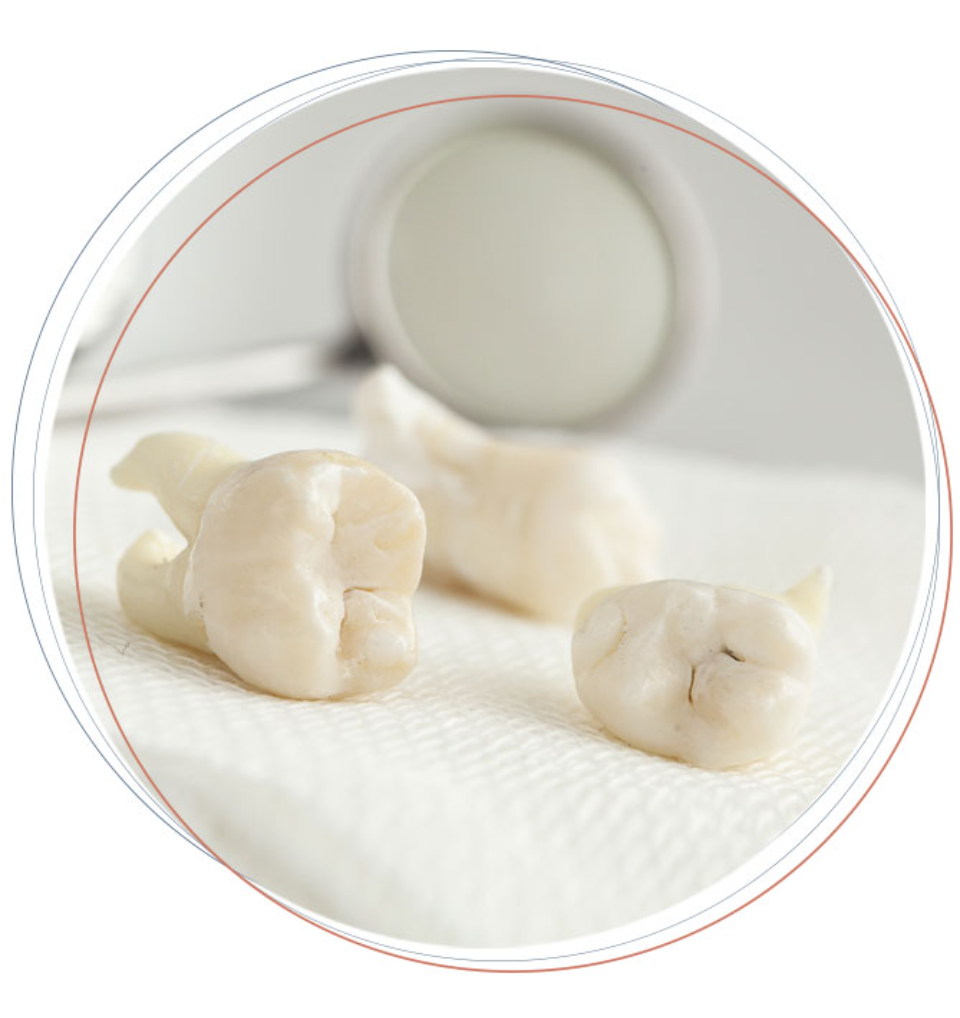 teeth models