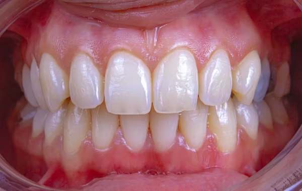 close-up shot of a person's complete teeth
